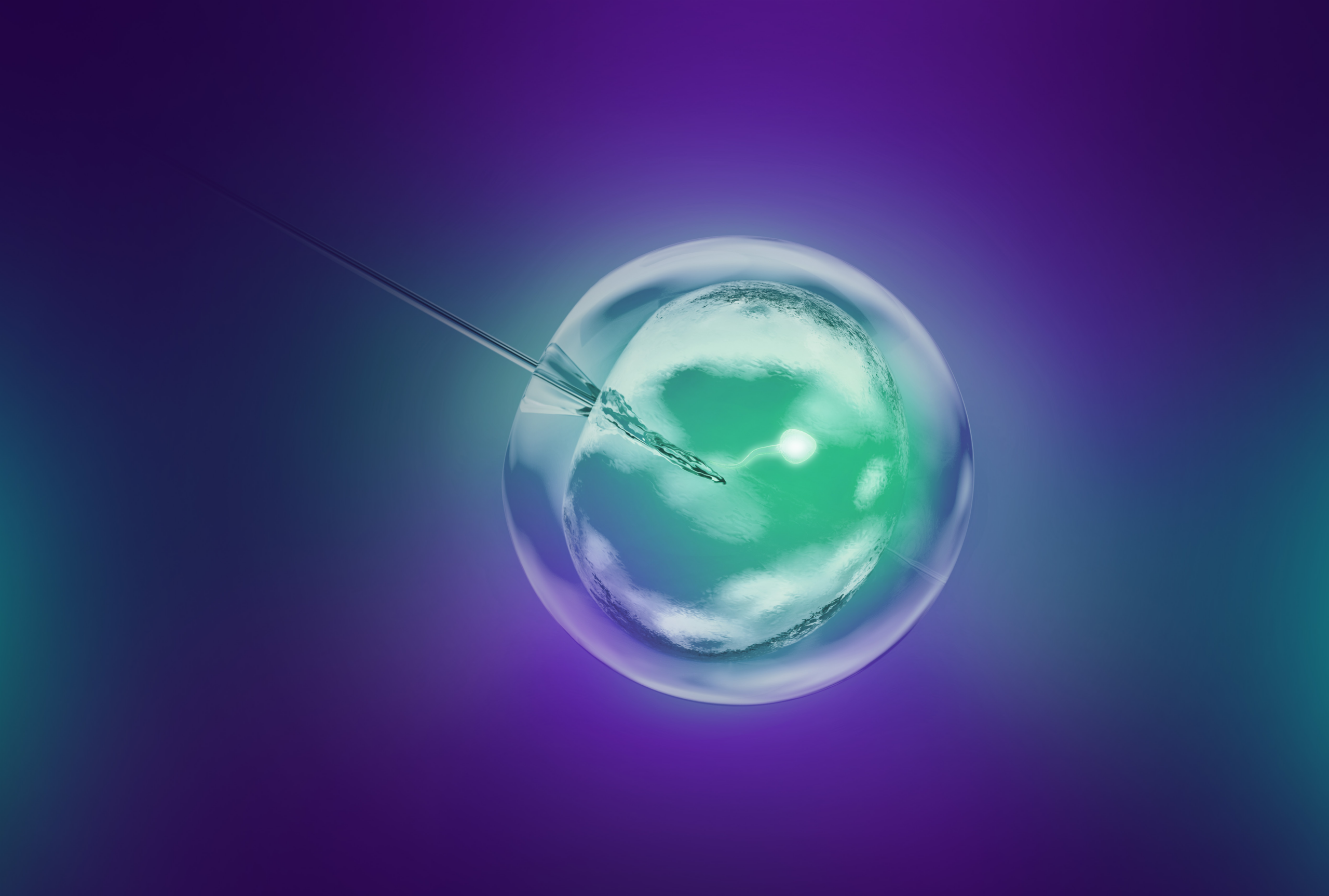 Illustration of ICSI (Intracytoplasmic Sperm Injection): a single sperm cell injected directly into the oocyte